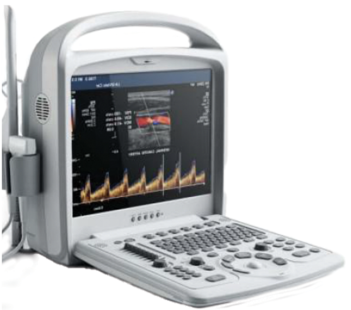 Portable Color Doppler